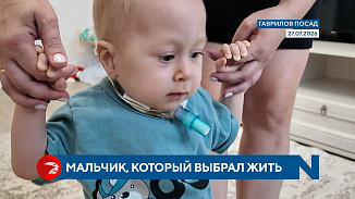  В Ивановской области спасают малыша с редчайшей патологией 